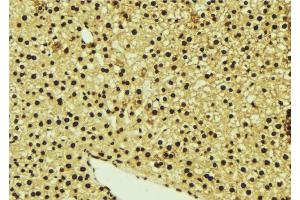 ABIN6277078 at 1/100 staining Mouse liver tissue by IHC-P. (LYN antibody  (C-Term))