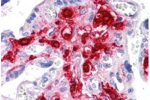 Human Placenta: Formalin-Fixed, Paraffin-Embedded (FFPE) (RNF144B antibody  (AA 1-101))