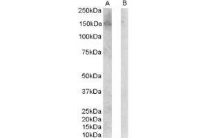 Image no. 1 for anti-Receptor Tyrosine-Protein Kinase ErbB-3 (ERBB3) (C-Term), (Isoform 1) antibody (ABIN374599) (ERBB3 antibody  (C-Term, Isoform 1))