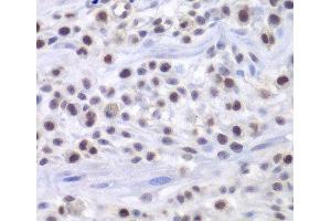 Immunohistochemistry of paraffin-embedded Mouse osteosarcoma using HAT1 Polyclonal Antibody at dilution of 1:200 (40x lens). (HAT1 antibody)