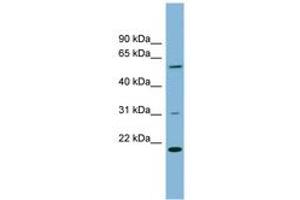 Image no. 1 for anti-TP53RK Binding Protein (TPRKB) (AA 35-84) antibody (ABIN6742046) (TPRKB antibody  (AA 35-84))