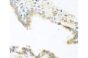 Immunohistochemistry of paraffin-embedded Mouse lung using RETN Polyclonal Antibody at dilution of 1:100 (40x lens). (Resistin antibody)