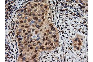 Image no. 7 for anti-EPM2A (Laforin) Interacting Protein 1 (EPM2AIP1) antibody (ABIN1498046) (EPM2AIP1 antibody)