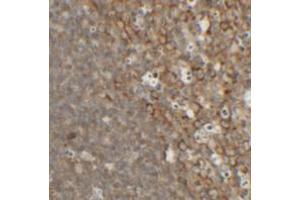 Immunohistochemical analysis of TFCP2L1 in rat colon tissue with TFCP2L1 polyclonal antibody  at 2.