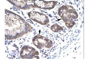 Image no. 2 for anti-Mesenchyme Homeobox 1 (MEOX1) (AA 38-87) antibody (ABIN6735804) (MEOX1 antibody  (AA 38-87))