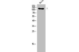 Western Blot analysis of Hela cells using Phospho-Flg (Y654) Polyclonal Antibody (FGFR1 antibody  (pTyr654))