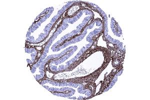 Fallopian tube mucosa Strong decorin immunostaining in the stroma while staining is completely lacking in epithelial cells decorin immunohistochemistry (Recombinant Decorin antibody  (AA 212-336))