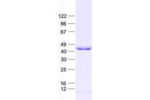 Validation with Western Blot (XRCC3 Protein (His tag))