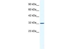 Western Blotting (WB) image for anti-Small Nuclear RNA Activating Complex, Polypeptide 2, 45kDa (SNAPC2) antibody (ABIN2463868) (SNAPC2 antibody)