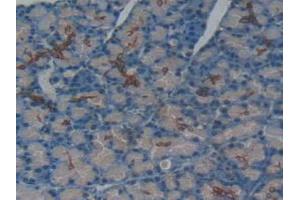 IHC-P analysis of Rat Pancreas Tissue, with DAB staining. (TNFRSF11A antibody  (AA 31-214))
