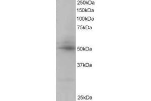 Western Blotting (WB) image for anti-CAMP Responsive Element Binding Protein 3-Like 4 (CREB3L4) (C-Term) antibody (ABIN2465555) (CREB3L4 antibody  (C-Term))