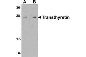 Western Blotting (WB) image for anti-Transthyretin (TTR) (Middle Region) antibody (ABIN1031141) (TTR antibody  (Middle Region))