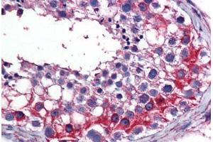 Human Testis: Formalin-Fixed, Paraffin-Embedded (FFPE) (TES antibody  (AA 1-422))
