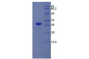 SDS-PAGE analysis of Rat Elastase 3B Protein. (Elastase 3B Protein)