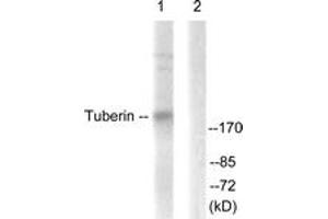Western blot analysis of extracts from 293 cells, treated with Anisomycin 25ug/ml 30', using Tuberin/TSC2 (Ab-939) Antibody.