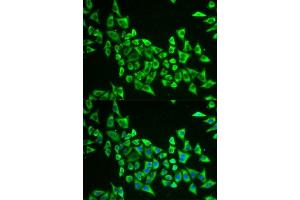 Immunofluorescence analysis of U2OS cells using MRPS30 antibody. (MRPS30 antibody  (AA 190-439))