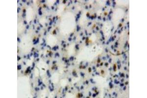 Used in DAB staining on fromalin fixed paraffin-embedded Lung tissue (Lipocalin 2 antibody  (AA 21-200))