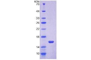 SDS-PAGE (SDS) image for Occludin (OCLN) ELISA Kit (ABIN6720584)