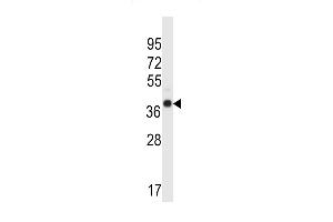 WDR89 Antibody (C-term) (ABIN657331 and ABIN2846400) western blot analysis in human normal Uterus tissue lysates (35 μg/lane).