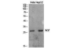 Western Blotting (WB) image for anti-Nerve Growth Factor (NGF) (Internal Region) antibody (ABIN3178911) (Nerve Growth Factor antibody  (Internal Region))