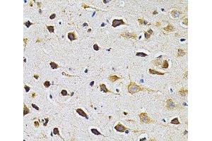 Immunohistochemistry of paraffin-embedded Rat brain using ADRBK1 Polyclonal Antibody at dilution of 1:200 (40x lens). (GRK2 antibody)