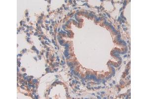 Figure. (SFTPD antibody  (AA 20-374))