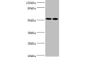 Western blot All lanes: Annexin A7 antibody at 4 μg/mL Lane 1: Jurkat whole cell lysate Lane 2: LO2 whole cell lysate Secondary Goat polyclonal to rabbit at 1/10000 dilution Predicted band size: 53, 51 kDa Observed band size: 53 kDa (Annexin VII antibody  (AA 259-488))