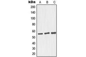 Western blot analysis of GRASP55 expression in HepG2 (A), Raji (B), LOVO (C) whole cell lysates. (GORASP2 antibody  (Center))