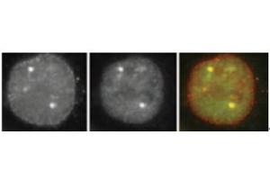 Immunofluorescence (IF) image for anti-Small Ubiquitin Related Modifier Protein 1 (SUMO1) (full length) antibody (ABIN2452138) (SUMO1 antibody  (full length))