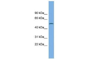 CAMK1G antibody used at 1 ug/ml to detect target protein. (CAMK1G antibody  (N-Term))