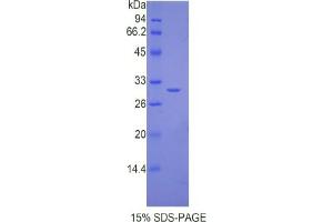 SDS-PAGE analysis of Mouse IL17RC Protein.