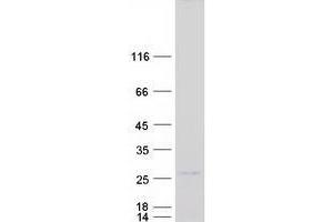 Validation with Western Blot (ZNF740 Protein (Myc-DYKDDDDK Tag))