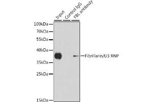Immunoprecipitation analysis of 200 μg extracts of HeLa cells using 1 μg Fibrillarin/U3 RNP antibody . (Fibrillarin antibody)
