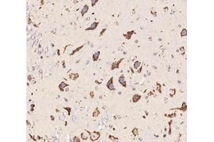 Immunohistochemistry analysis of paraffin-embedded mouse cerebellum using,Chrnb1 (ABIN7074841) at dilution of 1: 2000
