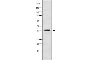 Western blot analysis of CaMKIbeta using LOVO whole cell lysates (PNCK antibody  (Internal Region))