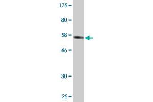 Western Blot detection against Immunogen (62. (CGR19 antibody  (AA 1-332))