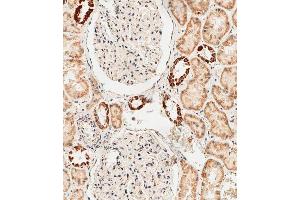 Immunohistochemical analysis of paraffin-embedded human kidney tissue using D performed on the Leica® BOND RXm. (GLS2 antibody  (AA 498-524))