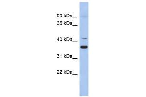 GADL1 antibody used at 1 ug/ml to detect target protein. (GADL1 antibody  (Middle Region))