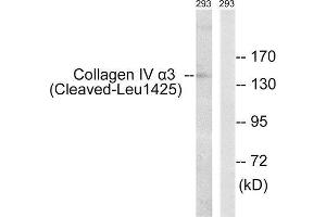 Western Blotting (WB) image for anti-Collagen, Type IV, alpha 3 (COL4A3) (Cleaved-Leu1425) antibody (ABIN1853542) (COL4a3 antibody  (Cleaved-Leu1425))