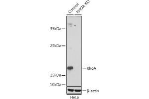 Western blot analysis of extracts from normal (control) and RhoA knockout (KO) HeLa cells, using RhoA antibody (ABIN7269865) at 1:1000 dilution. (RHOA antibody  (AA 1-193))
