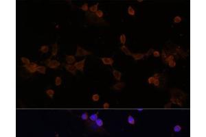 Immunofluorescence analysis of NIH-3T3 cells using UBE2L3 Polyclonal Antibody at dilution of 1:100 (40x lens).