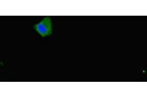 Immunofluorescent analysis of Hela cells using ABIN7160153 at dilution of 1:100 and Alexa Fluor 488-congugated AffiniPure Goat Anti-Rabbit IgG(H+L) (SLC16A10 antibody  (AA 159-201))