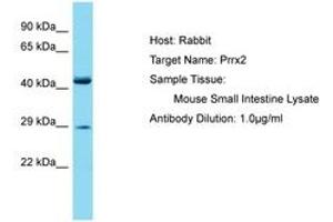 Image no. 1 for anti-Paired Related Homeobox 2 (PRRX2) (AA 151-200) antibody (ABIN6750240) (PRRX2 antibody  (AA 151-200))