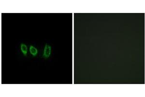 Immunofluorescence analysis of A549 cells, using CSTL1 antibody. (CSTL1 antibody  (Internal Region))