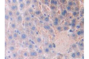 Used in DAB staining on fromalin fixed paraffin- embedded kidney tissue (Kallikrein 1 antibody  (AA 21-261))