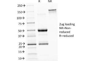 SDS-PAGE Analysis Purified ASRGL1 Mouse Monoclonal Antibody (CRASH/1289).