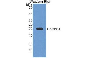 Western Blotting (WB) image for anti-Microfibrillar Associated Protein 2 (MFAP2) (AA 6-162) antibody (ABIN2119620) (MFAP2 antibody  (AA 6-162))