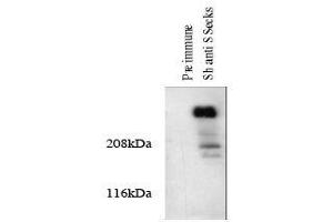 Image no. 1 for anti-A Kinase (PRKA) Anchor Protein 12 (AKAP12) antibody (ABIN296011) (AKAP12 antibody)