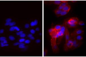 Human epithelial carcinoma cell line HEp-2 was stained with Mouse Anti-Human CD44-UNLB and DAPI. (Goat anti-Mouse IgG (Heavy & Light Chain) Antibody (TRITC))