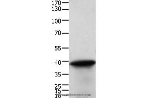 Western blot analysis of Human cervical cancer tissue, using TPM2 Polyclonal Antibody at dilution of 1:600 (TPM2 antibody)